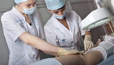 Chirurgische Behandlung von Krampfadern