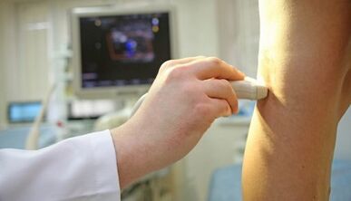 Laserbehandlung von Krampfadern